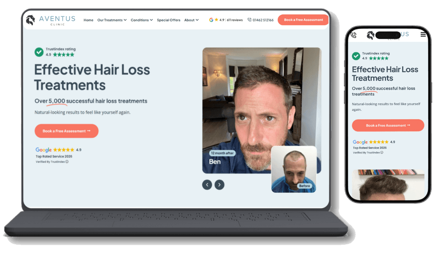 The Aventus Clinic hair loss treatments page and before and after gallery